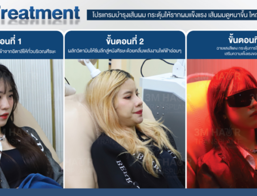 3M Hair Transplant by Masterpiece Hospital - Thaiclinic.co