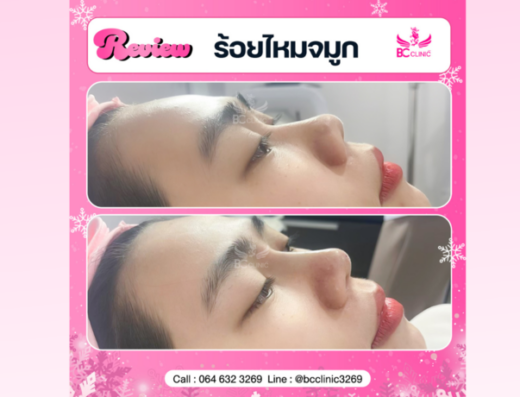 BC Clinic3269 - Thaiclinic.co