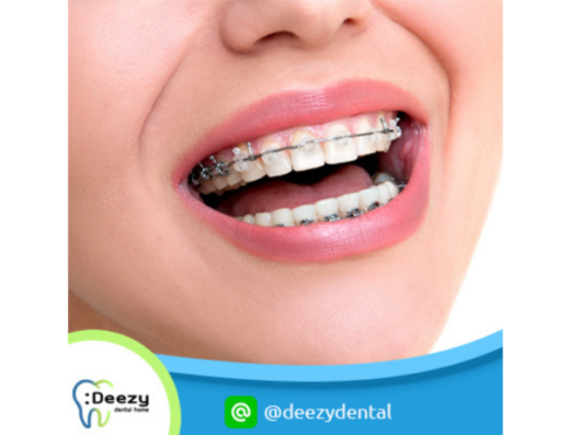 Deezy Dental Home Chok Chai 4 Branch - Thaiclinic.co