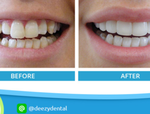 Deezy Dental Home Rangsit Klong 2 Branch - Thaiclinic.co