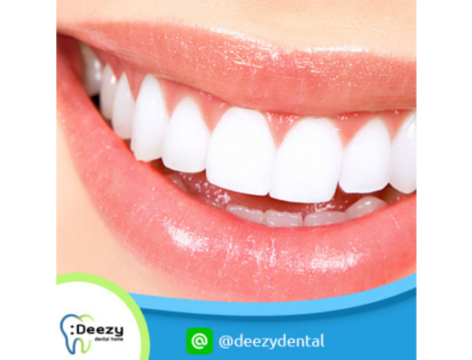 Deezy Dental Home Saint Louis Branch - Thaiclinic.co