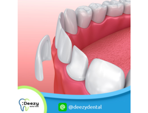 Deezy Dental Home Samrong Branch - Thaiclinic.co