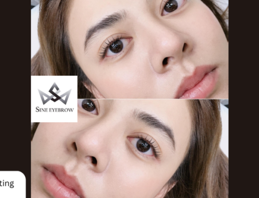 SINE Eyebrow - Thaiclinic.co