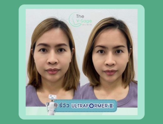 The V Sage Clinic Chonburi - Thaiclinic.co