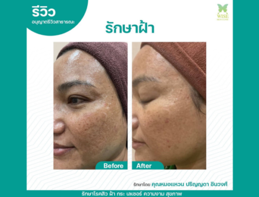 Wise Skin Clinic - Thaiclinic.co