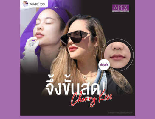 Apex Profound Beauty Central Eastville Branch - Thaiclinic.co