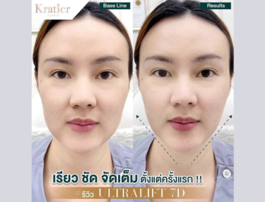 Kratier Clinic - Thaiclinic.co