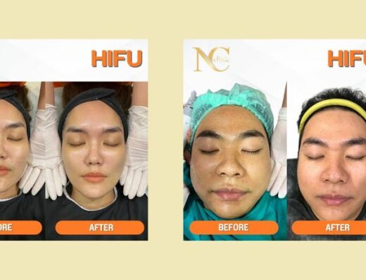 Natcha Clinic Skin - Thaiclinic.co